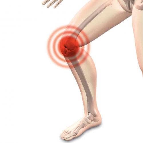 'arthrocalman-2384253_1920.jpg'